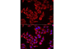Immunofluorescence analysis of HeLa cells using SRGN antibody (ABIN5974179). (SRGN antibody)