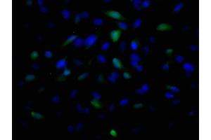 Immunofluorescence staining of U251 cells with ABIN7173630 at 1:100, counter-stained with DAPI. (Tumor Suppressor Gene On Chromosome 11 (TSG11) (AA 1-145) antibody)
