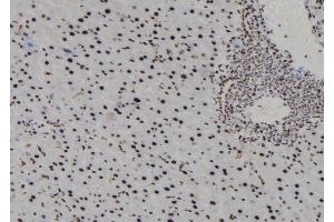 ABIN6278020 at 1/100 staining Mouse liver tissue by IHC-P.