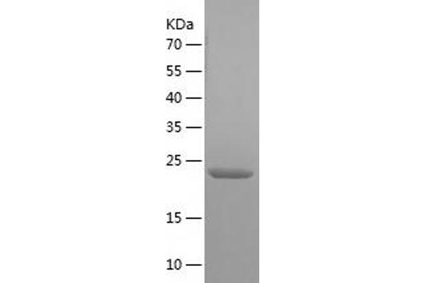 C11orf73 Protein (AA 1-197) (His tag)