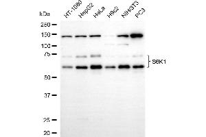 Western blotting analysis using S6K1 antibody (ABIN7800225).