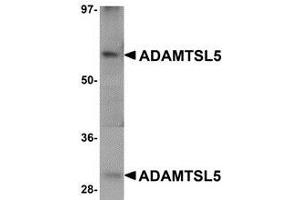 Western blot analysis of ADAMTSL5 in human skeletal muscle tissue lysate with AP30018PU-N ADAMTSL5 antibody at 1 μg/ml. (ADAMTS-Like 5 antibody  (C-Term))