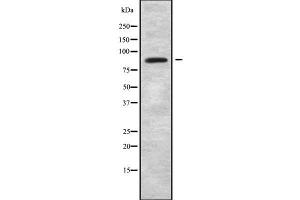 Western blot analysis of ARHGEF6 using K562 whole cell lysates (ARHGEF6 antibody  (N-Term))