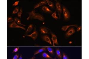 Immunofluorescence analysis of U-2 OS cells using MLPH Polyclonal Antibody at dilution of 1:100. (Melanophilin antibody)