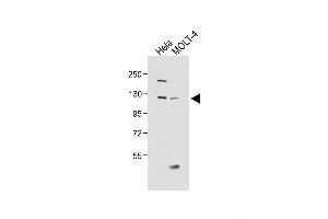 All lanes : Anti-SED Antibody (N-term) at 1:1000 dilution Lane 1: Hela whole cell lysate Lane 2: MOLT-4 whole cell lysate Lysates/proteins at 20 μg per lane. (SEMA6D antibody  (N-Term))