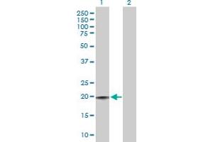 Western Blot analysis of CD3D expression in transfected 293T cell line by CD3D MaxPab polyclonal antibody. (CD3D antibody  (AA 1-171))