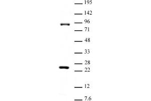 Suz12 antibody (pAb) tested by Western blot. (SUZ12 antibody  (C-Term))