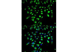 Immunofluorescence analysis of MCF-7 cells using CD86 antibody (ABIN5970542). (CD86 antibody)