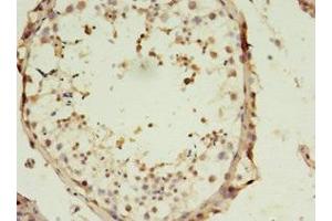 Immunohistochemistry of paraffin-embedded human testis tissue using ABIN7170098 at dilution of 1:100 (SLC13A4 antibody  (AA 134-273))