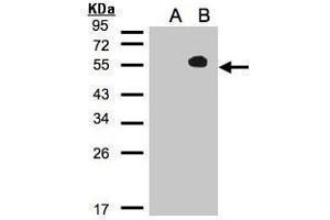 WB Image Western Blot analysis of TAB1 expression in transfected 293T cell line by MAP3K7IP1 polyclonal antibody. (TAB1 antibody)