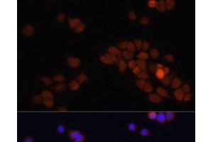 Immunofluorescence analysis of HT-29 cells using APC Polyclonal Antibody at dilution of 1:100. (APC antibody)