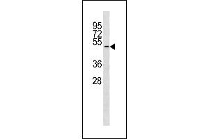 TUBD1 Antibody (C-term) (ABIN1881958 and ABIN2843289) western blot analysis in ZR-75-1 cell line lysates (35 μg/lane). (TUBD1 antibody  (C-Term))