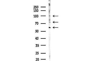 Western blot analysis of lysates from Hela cells(starvation 24h treatment), using SDC1 Antibody at 1/1000 dilution.