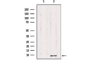 Western blot analysis of extracts from 293, using TMSB4X Antibody. (TMSB4X antibody  (N-Term))