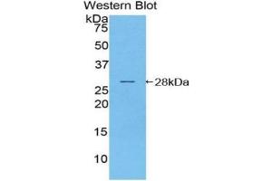 Western blot analysis of the recombinant protein. (NOD1 antibody  (AA 612-826))