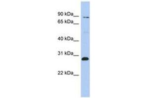 Image no. 1 for anti-Zinc Finger Protein 148 (ZNF148) (AA 287-336) antibody (ABIN6742498) (ZNF148 antibody  (AA 287-336))