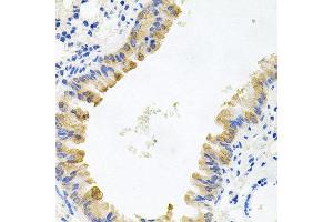 Immunohistochemistry of paraffin-embedded mouse lung using ALKBH8 antibody at dilution of 1:100 (x40 lens). (ALKBH8 antibody)