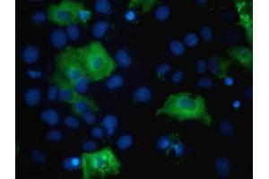 Anti-TBC1D4 mouse monoclonal antibody (ABIN2454437) immunofluorescent staining of COS7 cells transiently transfected by pCMV6-ENTRY TBC1D4 (RC212105). (TBC1D4 antibody)