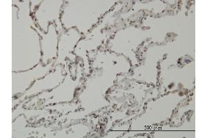 Immunoperoxidase of monoclonal antibody to PIM1 on formalin-fixed paraffin-embedded human lung. (PIM1 antibody  (AA 1-313))