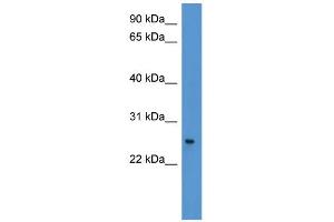 WB Suggested Anti-PYCARD Antibody Titration: 0. (PYCARD antibody  (C-Term))
