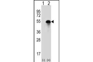 Western blot analysis of CA14 (arrow) using rabbit polyclonal CA14 Antibody (N-term) (ABIN391473 and ABIN2841441). (CA14 antibody  (N-Term))