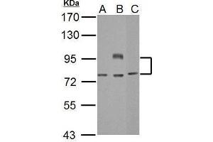 WB Image Sample (30 ug of whole cell lysate) A: Jurkat B: Raji C: NCI-H929 7. (BCL6 antibody  (Internal Region))