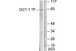 Western Blotting (WB) image for anti-POU Domain, Class 2, Transcription Factor 1 (POU2F1) (N-Term) antibody (ABIN1848704) (POU2F1 antibody  (N-Term))