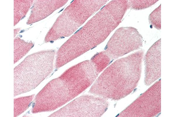 WDFY1 antibody  (N-Term)