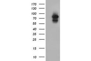 Western Blotting (WB) image for anti-Aryl Hydrocarbon Receptor Nuclear Translocator (ARNT) antibody (ABIN1496730) (ARNT antibody)