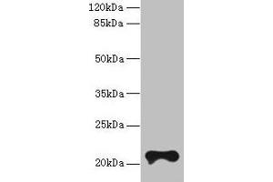 Western blot All lanes: TMEM154 antibody at 6 μg/mL + MCF-7 whole cell lysate Secondary Goat polyclonal to rabbit IgG at 1/10000 dilution Predicted band size: 21 kDa Observed band size: 21 kDa (TMEM154 antibody  (AA 97-183))