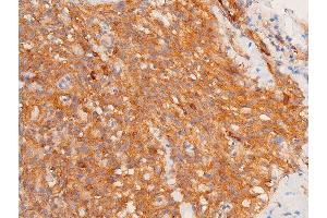 Immunohistochemistry (IHC) image for anti-Checkpoint Kinase 1 (CHEK1) (pSer317) antibody (ABIN6255201)