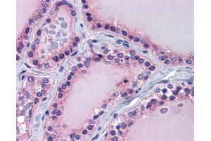 Immunohistochemistry (IHC) image for anti-Paired Box 8 (PAX8) (Middle Region) antibody (ABIN2775952) (PAX8 antibody  (Middle Region))
