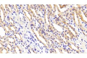 Detection of MMP1 in Rat Kidney Tissue using Polyclonal Antibody to Matrix Metalloproteinase 1 (MMP1) (MMP1 antibody  (AA 169-464))