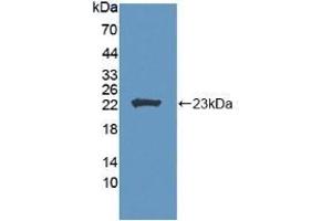Detection of Recombinant LCAT, Human using Polyclonal Antibody to Lecithin Cholesterol Acyltransferase (LCAT) (LCAT antibody  (AA 41-210))