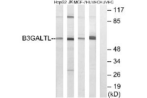 Immunohistochemistry analysis of paraffin-embedded human liver carcinoma tissue using B3GALTL antibody.