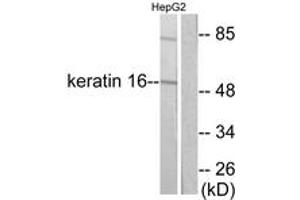 Western blot analysis of extracts from HepG2 cells, using Keratin 16 Antibody. (KRT16 antibody  (AA 421-470))