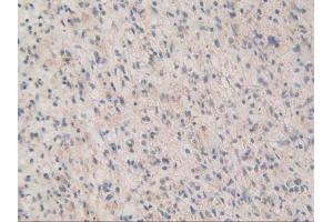 Figure. (MAPKAP Kinase 2 antibody  (AA 139-367))