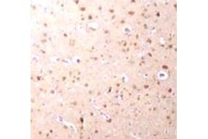 Immunohistochemical staining of human brain tissue with 2. (NANOS3 antibody  (C-Term))