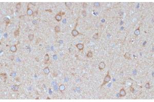 Immunohistochemistry of paraffin-embedded Rat brain using COPG2 Polyclonal Antibody at dilution of 1:100 (40x lens). (COPG2 antibody)