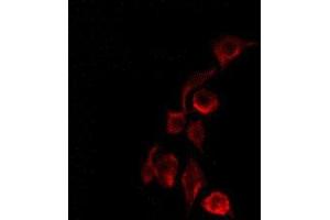 ABIN6275255 staining COLO205 by IF/ICC. (MEGF8 antibody  (Internal Region))