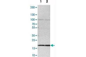Western blot analysis of cell lysates with SSR3 polyclonal antibody .