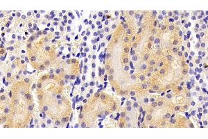 Detection of ALPL in Mouse Kidney Tissue using Polyclonal Antibody to Alkaline Phosphatase, Tissue-nonspecific (ALPL) (ALPL antibody  (AA 18-335))