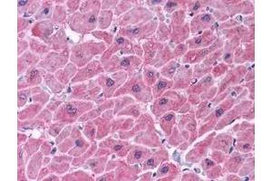 Immunohistochemistry of ARC in human heart tissue (A) and skeletal muscle (B) with ARC antibody at 5 μg/ml. (NOL3 antibody  (C-Term))