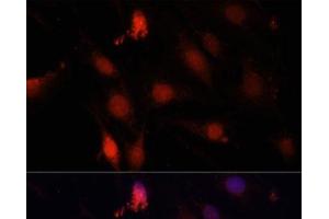 Immunofluorescence analysis of C6 cells using GBX2 Polyclonal Antibody at dilution of 1:100. (GBX2 antibody)