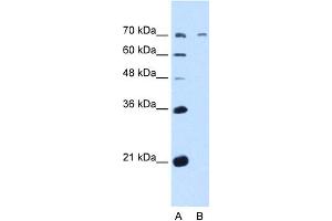 WB Suggested Anti-GALNT6 Antibody Titration:  5. (GALNT6 antibody  (N-Term))