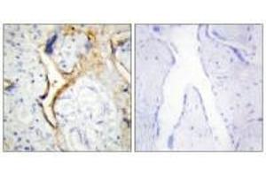 Immunohistochemistry analysis of paraffin-embedded human placenta tissue using CKI-ε antibody. (CK1 epsilon antibody)