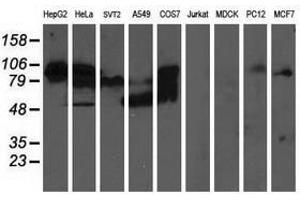 Image no. 2 for anti-Aldehyde Dehydrogenase 3 Family, Member A2 (ALDH3A2) antibody (ABIN1496595) (ALDH3A2 antibody)