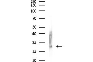 Western blot analysis of lysates from Hela cells(starvation,24h treatment), using PGAM5 Antibody at 1/1000 dilution.