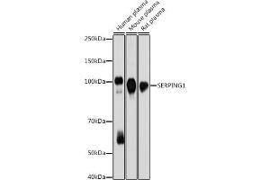 Western blot analysis of extracts of various cell lines, using SERPING1 antibody (ABIN7270250) at 1:1000 dilution. (SERPING1 antibody)