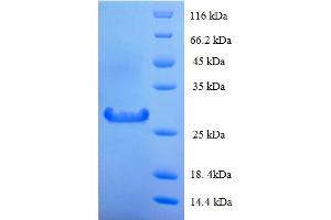 SDS-PAGE (SDS) image for Lysozyme (LYZ) (AA 19-148) protein (His-SUMO Tag) (ABIN5709889) (LYZ Protein (AA 19-148) (His-SUMO Tag))